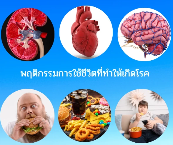 ปัจจัยที่ทำให้เกิดโรคเรื้อรัง