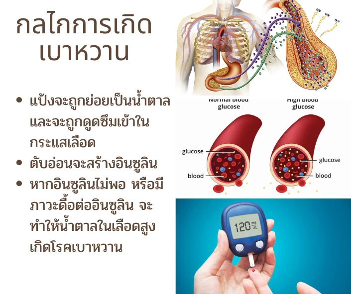 กลไกการเกิดโรคเบาหวาน