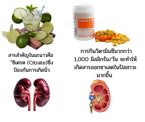  น้ำมะนาวป้องกันการเกิดนิ่ว