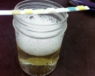 ปัสสาวะเป็นพอง