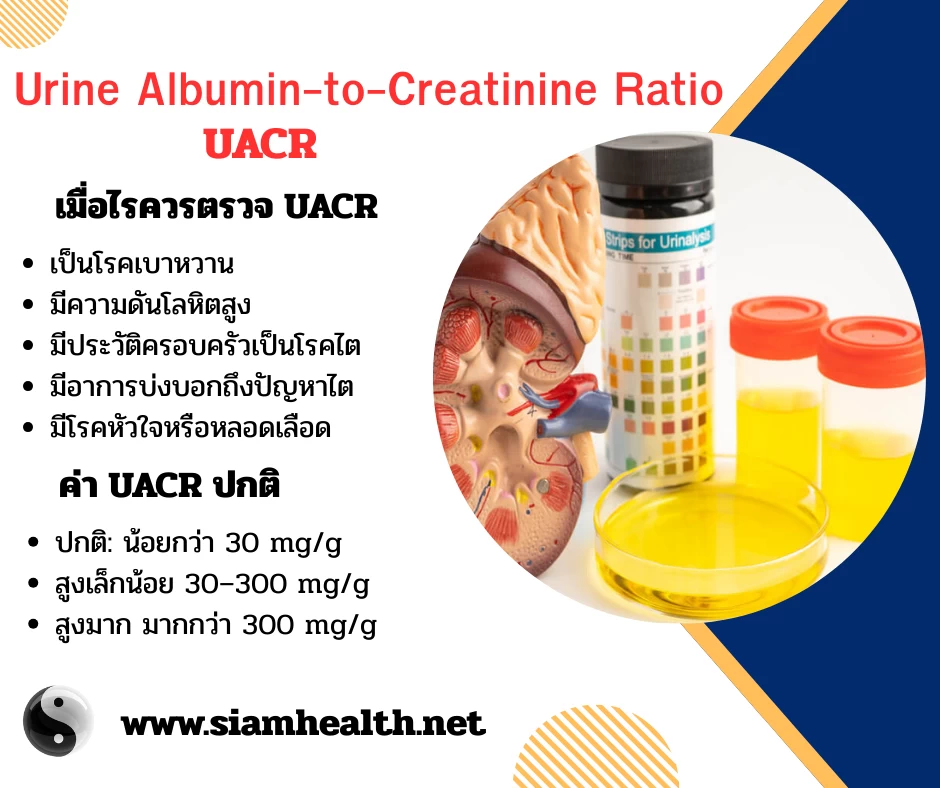 ไตรั่วพบโปรตีนในปัสสาวะ