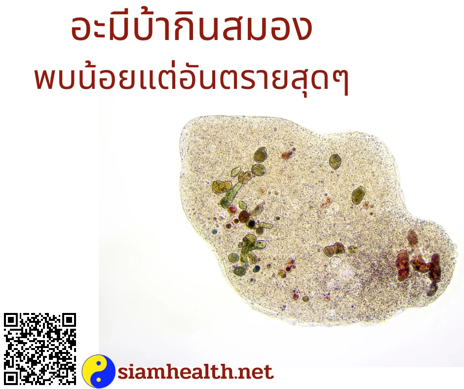 อะมีบ้ากินสมอง