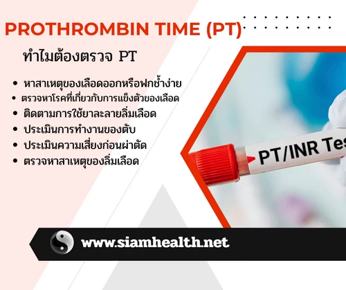 prothrombin time