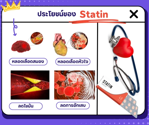 ประโยชน์ของ statin