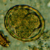 A. lumbricoides fertilized egg