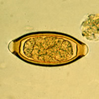 T. trichiura egg