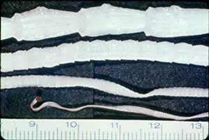 T. saginata adult worm