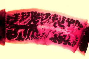 T. solium gravid proglottids