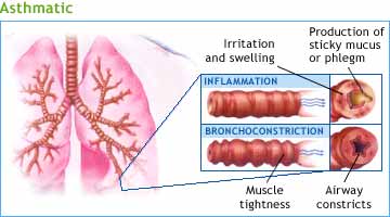 Asthmatic Lungs