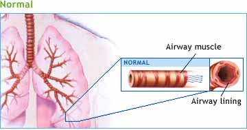 Normal Lungs