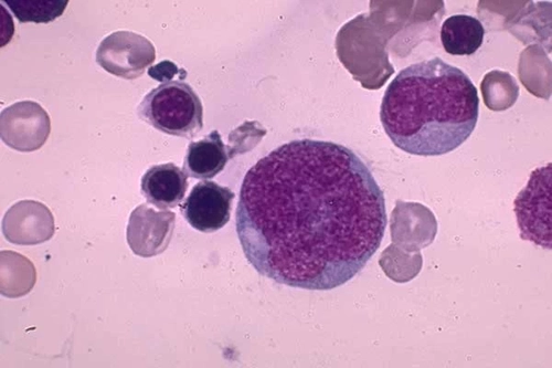 Myeloblasts