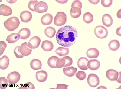 เซลล์เม็ดเลือดขาวชนิด neutrophil