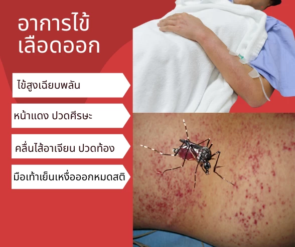 อาการไข้เลือดออก