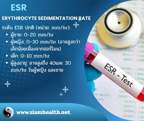 การตรวจ ESR โดยวัดอัตราการตกตะกอนของเม็ดเลือดแดงในหลอดทดลอง