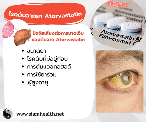 โรคตับจาก atorvastatin