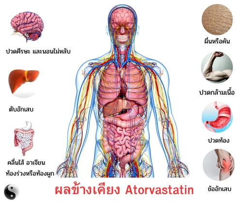 ผลข้างเคียงของ atorvastatin