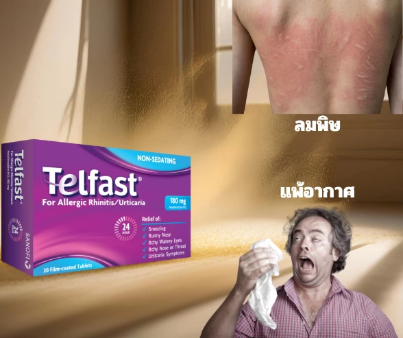 fexofernadine