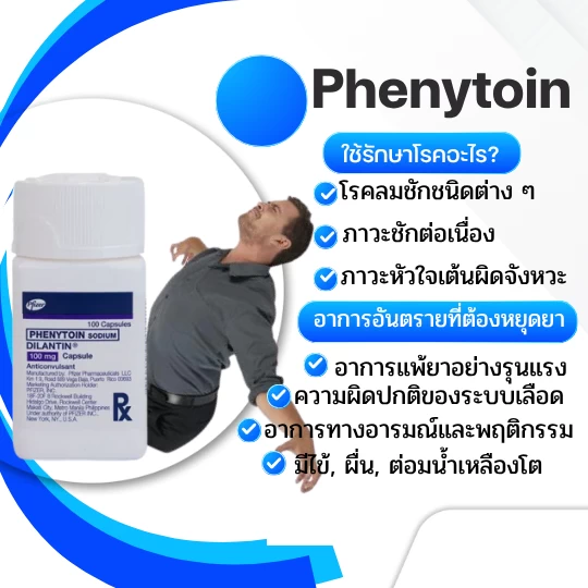 phenytoin-ยากันชัก