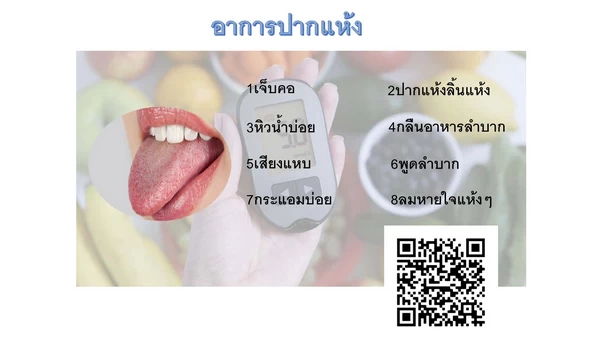 อาการปากแห้ง