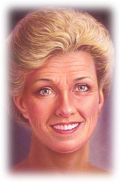 การทำ baby face